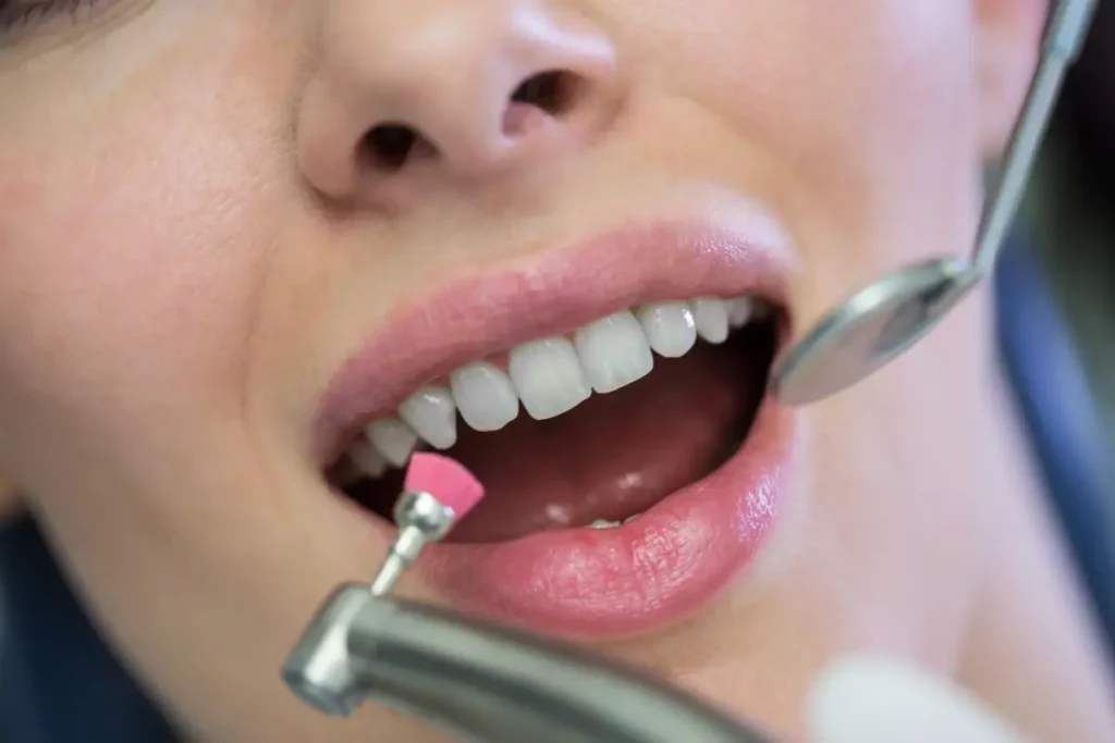 Tratamientos con periodoncia experta en Córdoba, España