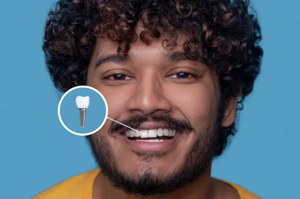 Precios de los implantes dentales