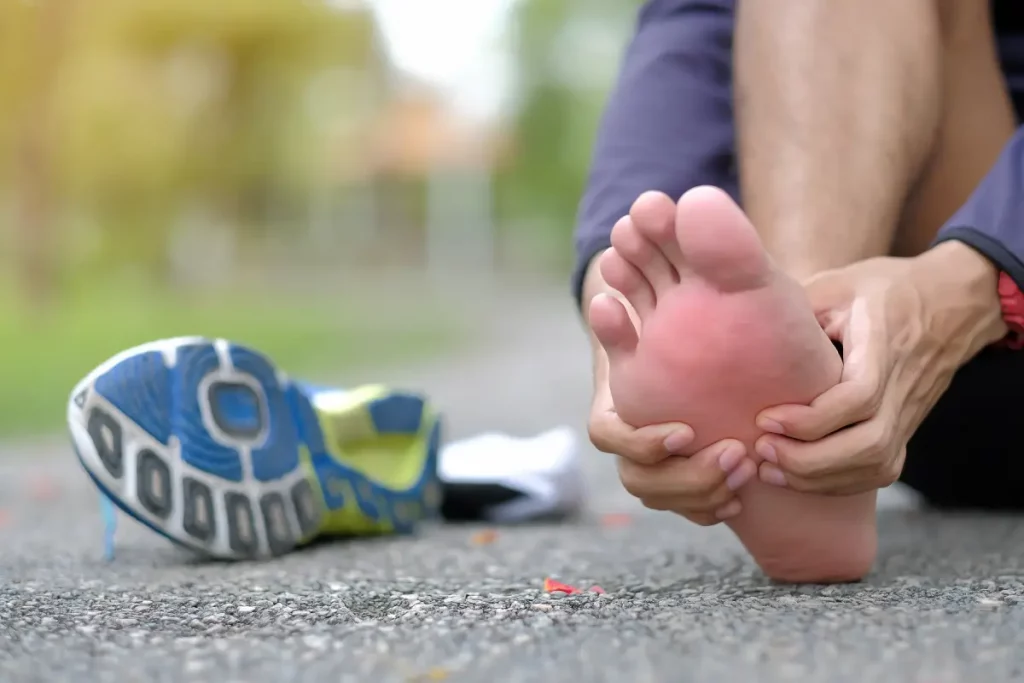 Fascitis Plantar