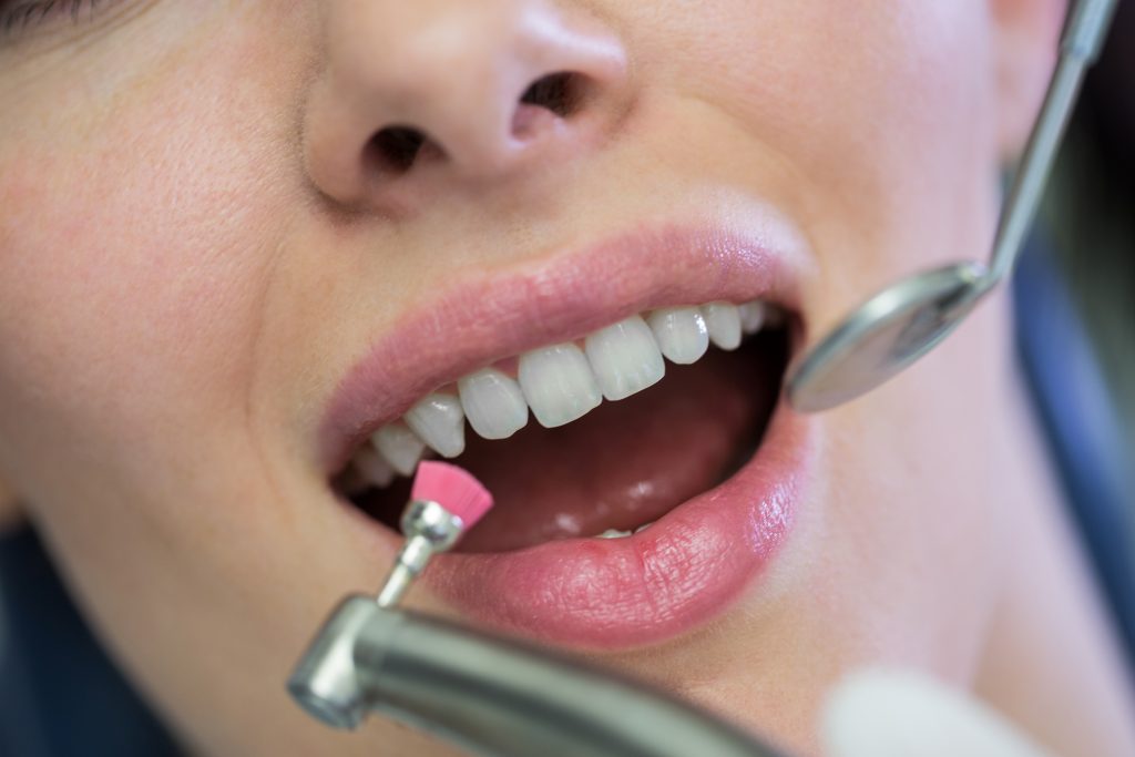 tratamiento de periodoncia en Córdoba en clínica dental